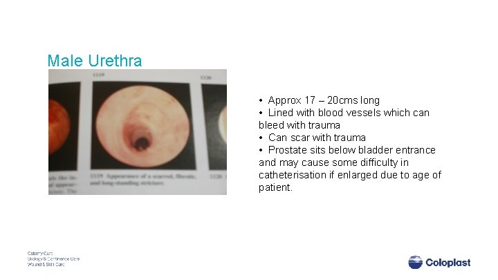 Male Urethra • Approx 17 – 20 cms long • Lined with blood vessels