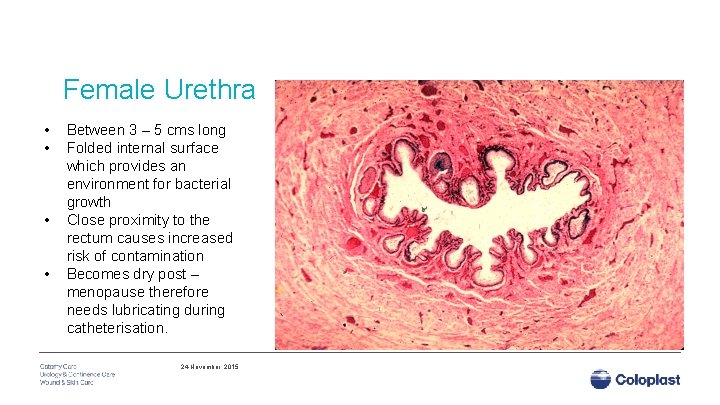 Female Urethra • • Between 3 – 5 cms long Folded internal surface which