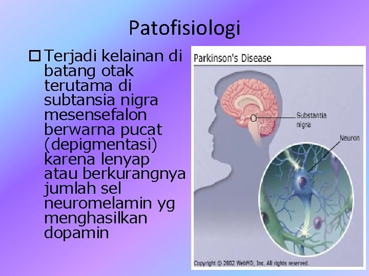 Patofisiologi Terjadi kelainan di batang otak terutama di subtansia nigra mesensefalon berwarna pucat (depigmentasi)