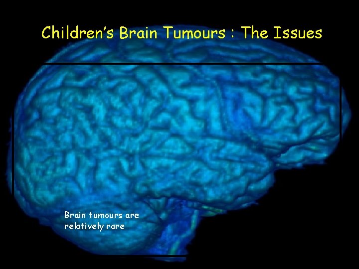 Children’s Brain Tumours : The Issues Brain tumours are relatively rare 