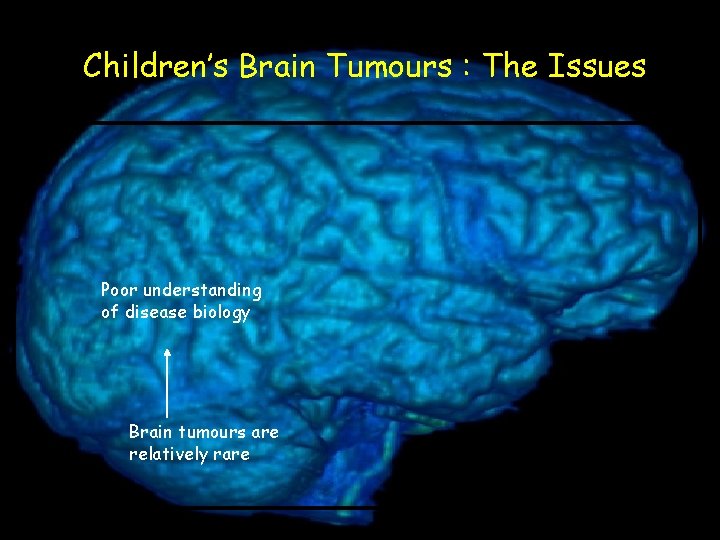 Children’s Brain Tumours : The Issues Poor understanding of disease biology Brain tumours are