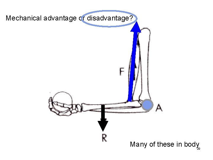 Mechanical advantage or disadvantage? Many of these in body 29 