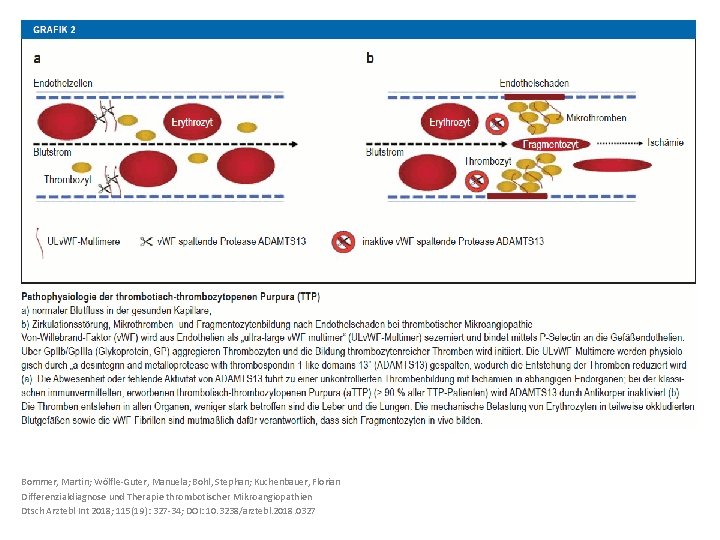 Bommer, Martin; Wölfle-Guter, Manuela; Bohl, Stephan; Kuchenbauer, Florian Differenzialdiagnose und Therapie thrombotischer Mikroangiopathien Dtsch