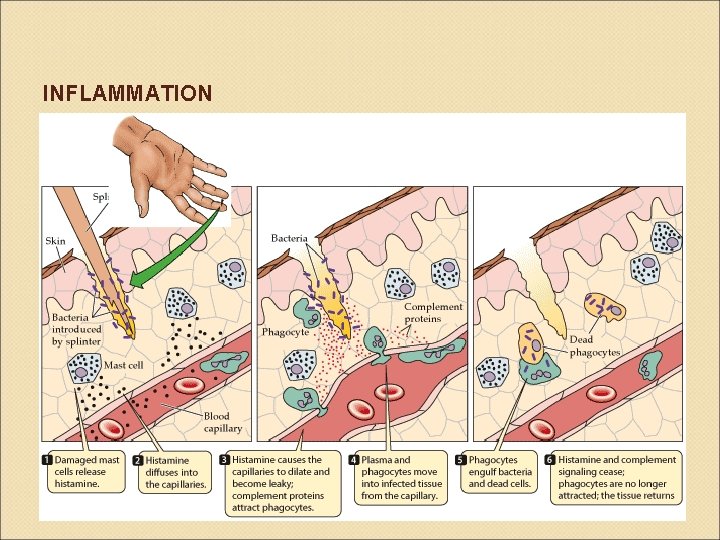 INFLAMMATION 