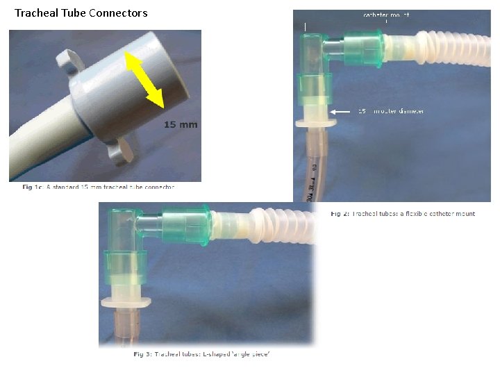 Tracheal Tube Connectors Tracheal Tube Connectors