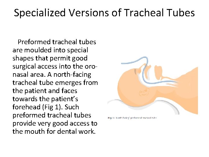Specialized Versions of Tracheal Tubes Preformed tracheal tubes are moulded into special shapes that Specialized Versions of Tracheal Tubes Preformed tracheal tubes are moulded into special shapes that