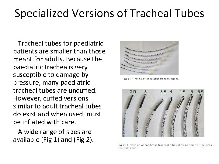 Specialized Versions of Tracheal Tubes Tracheal tubes for paediatric patients are smaller than those Specialized Versions of Tracheal Tubes Tracheal tubes for paediatric patients are smaller than those