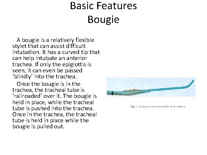 Basic Features Bougie A bougie is a relatively flexible stylet that can assist difficult Basic Features Bougie A bougie is a relatively flexible stylet that can assist difficult