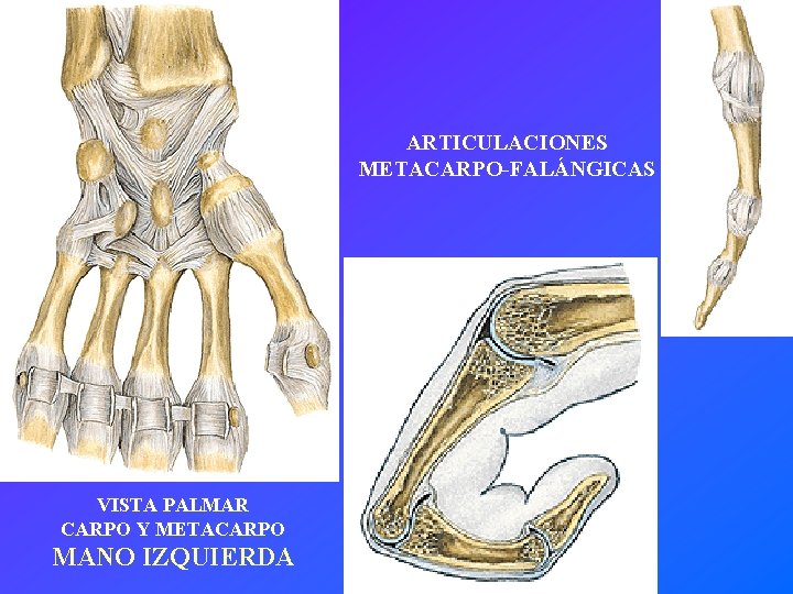 ARTICULACIONES METACARPO-FALÁNGICAS VISTA PALMAR CARPO Y METACARPO MANO IZQUIERDA 