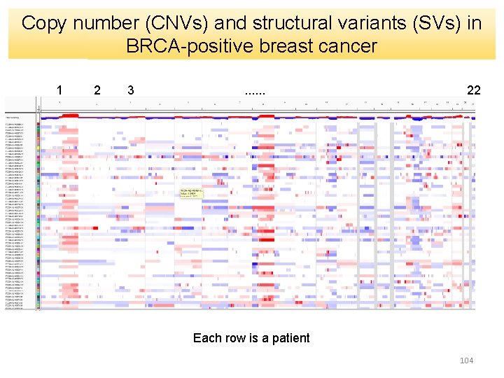 Copy number (CNVs) and structural variants (SVs) in BRCA-positive breast cancer 1 2 3