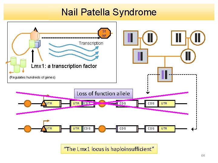 Nail Patella Syndrome St op! Transcription Lmx 1: a transcription factor (Regulates hundreds of