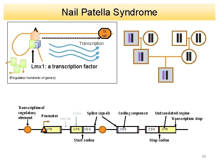 Nail Patella Syndrome St op! Transcription Lmx 1: a transcription factor (Regulates hundreds of