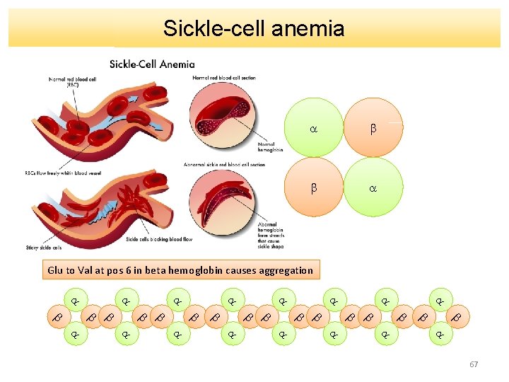 Sickle-cell anemia a b b a Glu to Val at pos 6 in beta