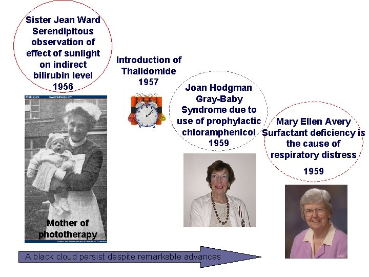 Sister Jean Ward Serendipitous observation of effect of sunlight on indirect bilirubin level 1956