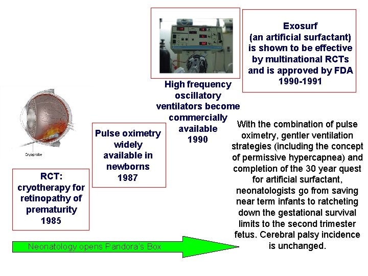 Exosurf (an artificial surfactant) is shown to be effective by multinational RCTs and is