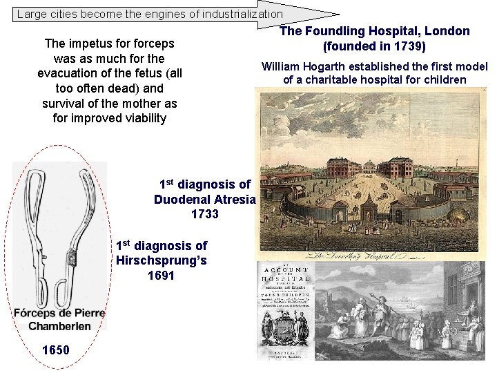 Large cities become the engines of industrialization The impetus forceps was as much for