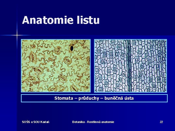 Anatomie listu Stomata – průduchy – buněčná ústa SOŠS a SOU Kadaň Botanika -