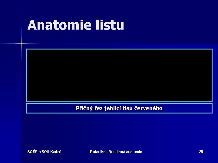 Anatomie listu Příčný řez jehlicí tisu červeného SOŠS a SOU Kadaň Botanika - Rostlinná