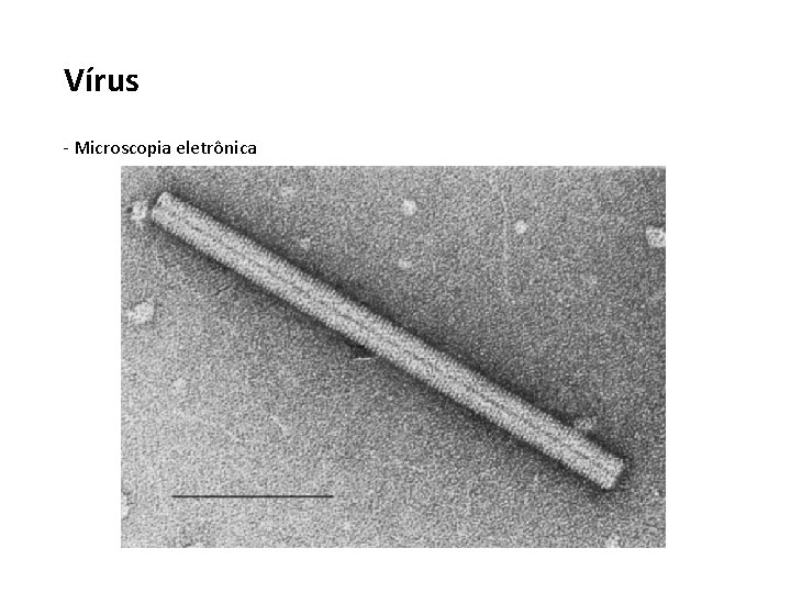 Vírus - Microscopia eletrônica 