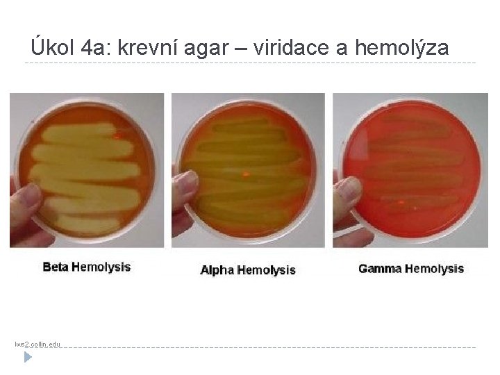 Úkol 4 a: krevní agar – viridace a hemolýza lws 2. collin. edu 