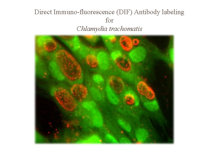 Direct Immuno-fluorescence (DIF) Antibody labeling for Chlamydia trachomatis 