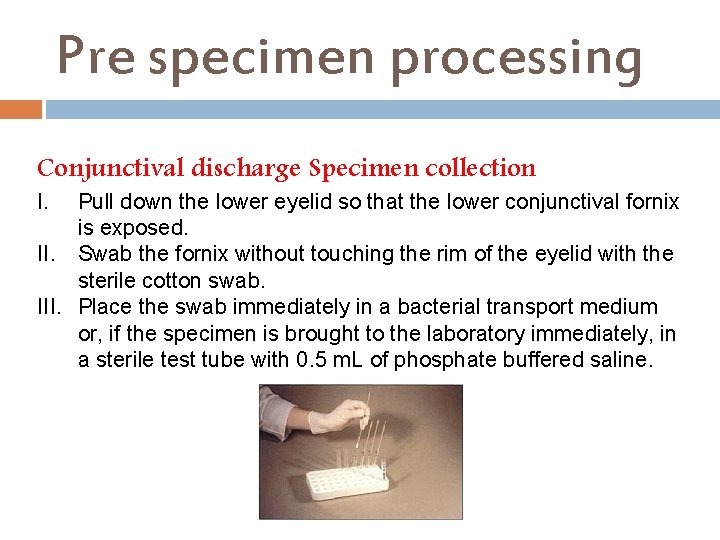 Pre specimen processing Conjunctival discharge Specimen collection I. Pull down the lower eyelid so