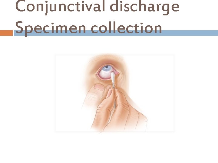 Conjunctival discharge Specimen collection 