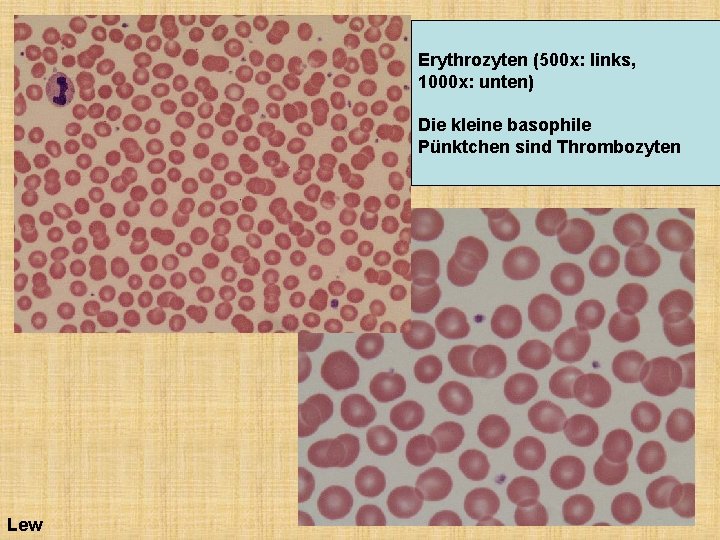 Erythrozyten (500 x: links, 1000 x: unten) Die kleine basophile Pünktchen sind Thrombozyten Lew