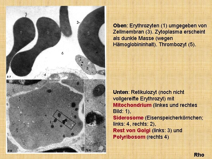 Oben: Erythrozyten (1) umgegeben von Zellmembran (3). Zytoplasma erscheint als dunkle Masse (wegen Hämoglobininhalt).
