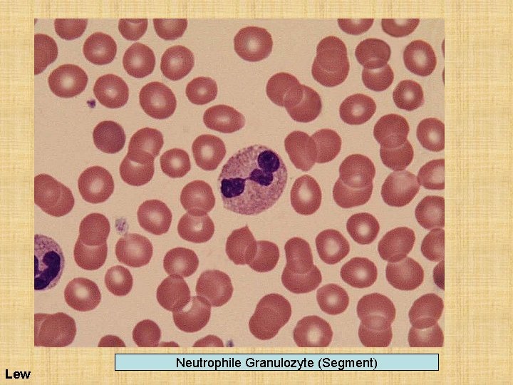 Lew Neutrophile Granulozyte (Segment) 