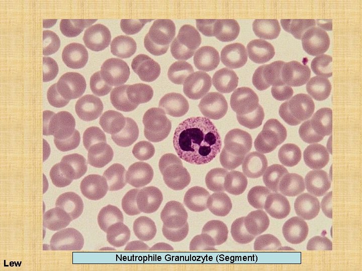 Lew Neutrophile Granulozyte (Segment) 