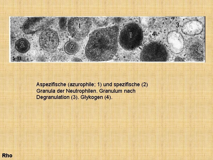 Aspezifische (azurophile; 1) und spezifische (2) Granula der Neutrophilen. Granulum nach Degranulation (3). Glykogen