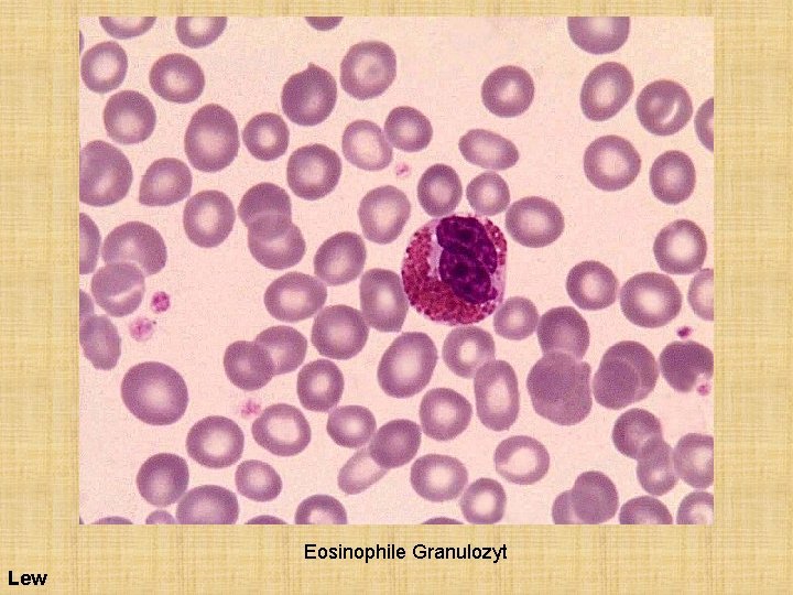 Eosinophile Granulozyt Lew 