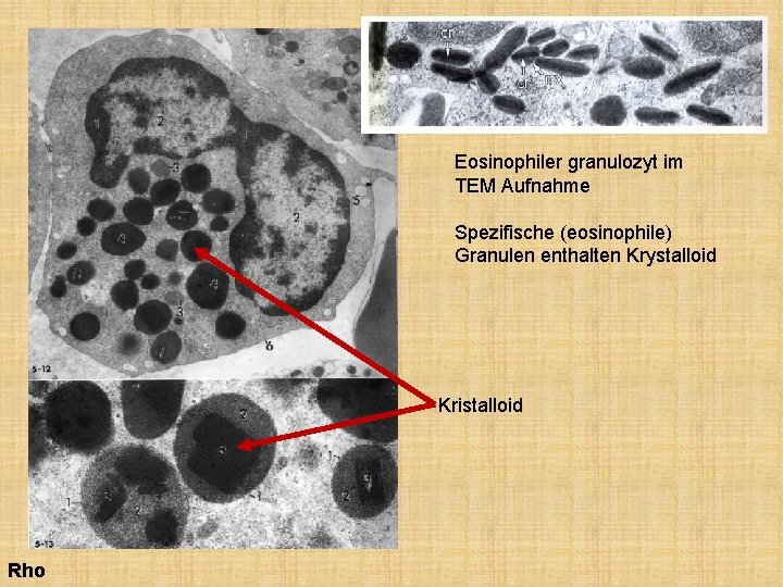 Eosinophiler granulozyt im TEM Aufnahme Spezifische (eosinophile) Granulen enthalten Krystalloid Kristalloid Rho 