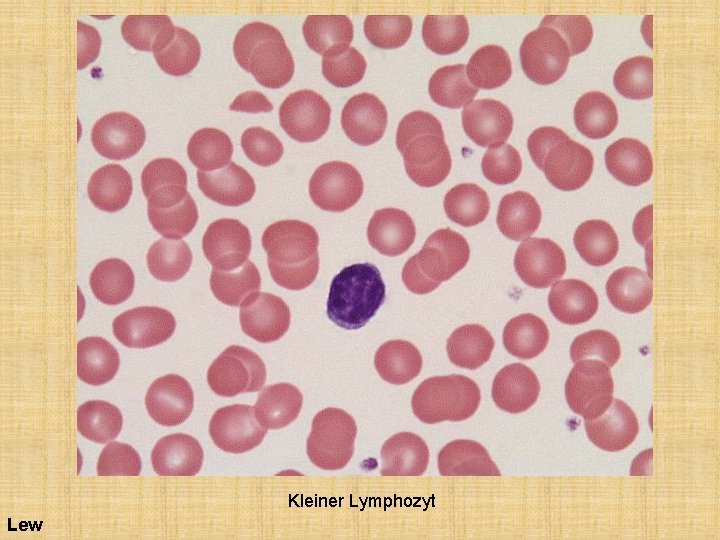 Kleiner Lymphozyt Lew 