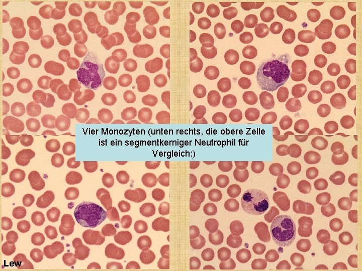 Vier Monozyten (unten rechts, die obere Zelle ist ein segmentkerniger Neutrophil für Vergleich: )