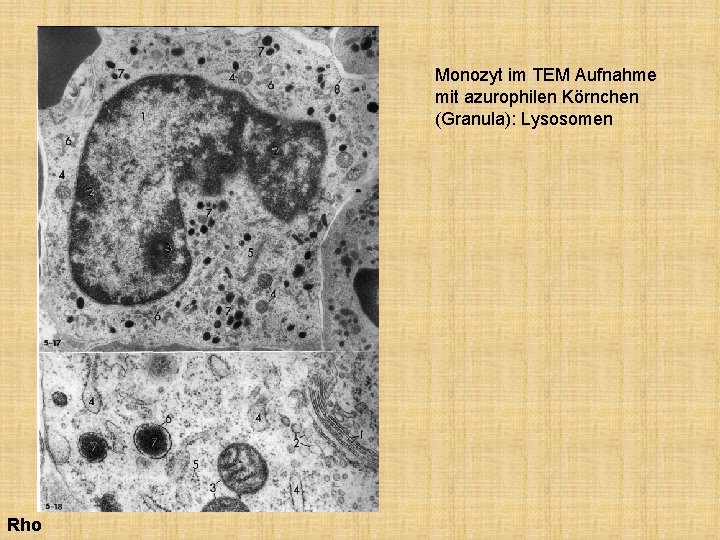 Monozyt im TEM Aufnahme mit azurophilen Körnchen (Granula): Lysosomen Rho 