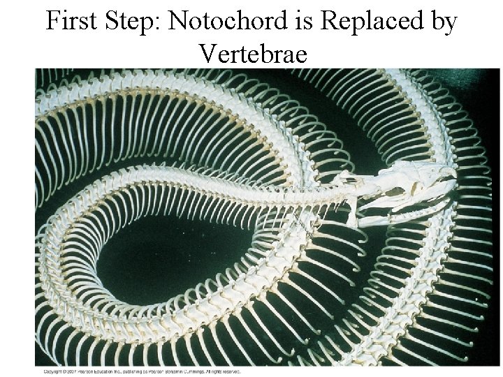 First Step: Notochord is Replaced by Vertebrae 