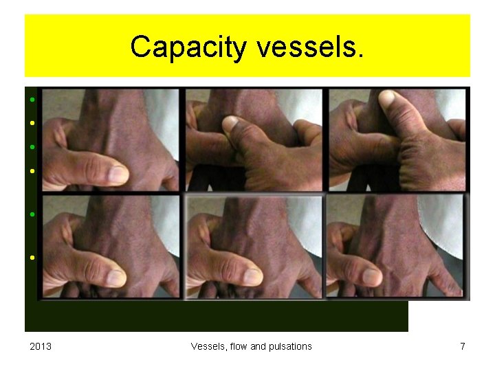Capacity vessels. • • Veins and venules. Thin wall, easily distended. Little muscles but