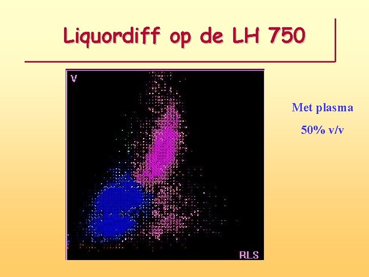 Liquordiff op de LH 750 Met plasma 50% v/v 