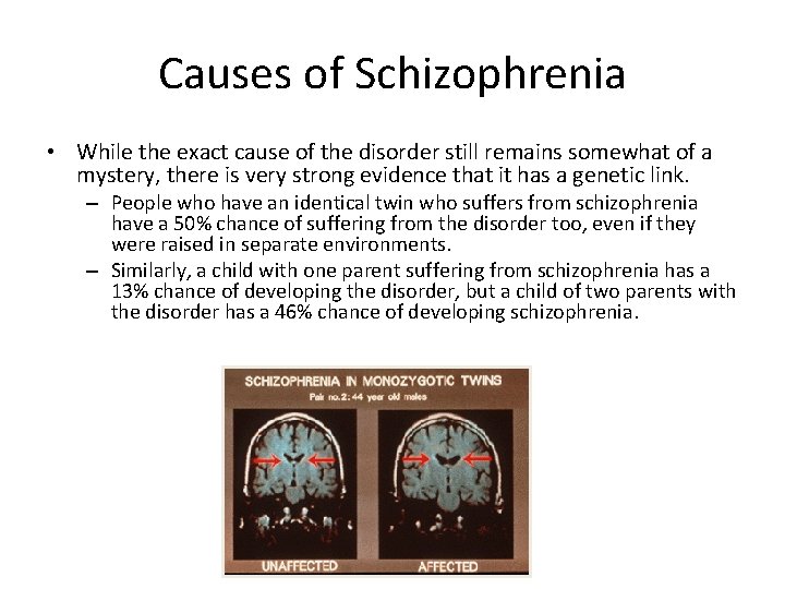 Causes of Schizophrenia • While the exact cause of the disorder still remains somewhat