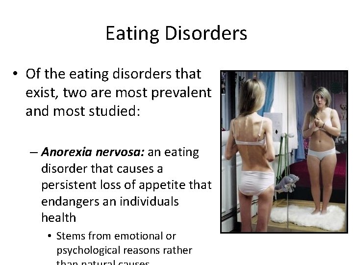 Eating Disorders • Of the eating disorders that exist, two are most prevalent and