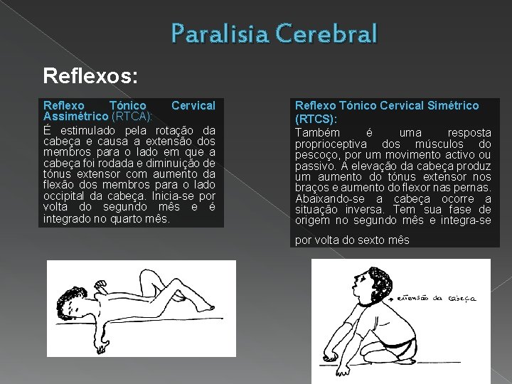 Paralisia Cerebral Reflexos: Reflexo Tónico Cervical Assimétrico (RTCA): É estimulado pela rotação da cabeça