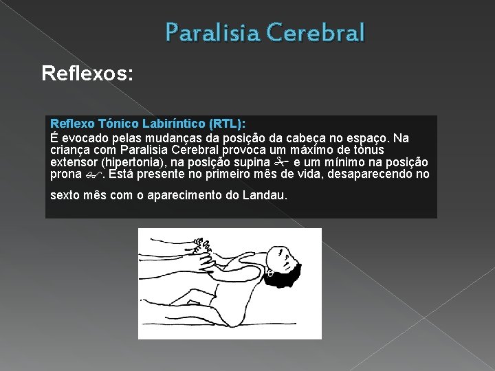 Paralisia Cerebral Reflexos: Reflexo Tónico Labiríntico (RTL): É evocado pelas mudanças da posição da