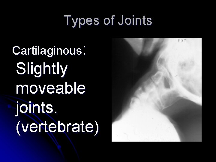 Types of Joints Cartilaginous: Slightly moveable joints. (vertebrate) 