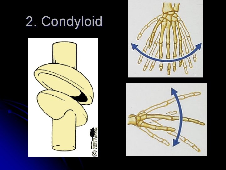 2. Condyloid 