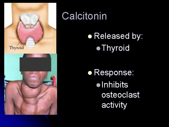 Calcitonin l Released by: l Thyroid l Response: l Inhibits osteoclast activity 