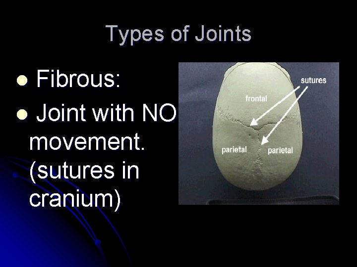 Types of Joints Fibrous: l Joint with NO movement. (sutures in cranium) l 