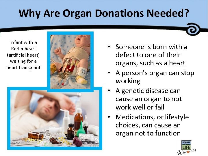 Why Are Organ Donations Needed? Infant with a Berlin heart (artificial heart) waiting for
