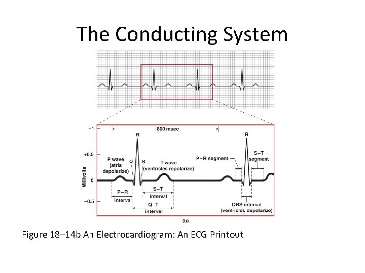 The Conducting System Figure 18– 14 b An Electrocardiogram: An ECG Printout 